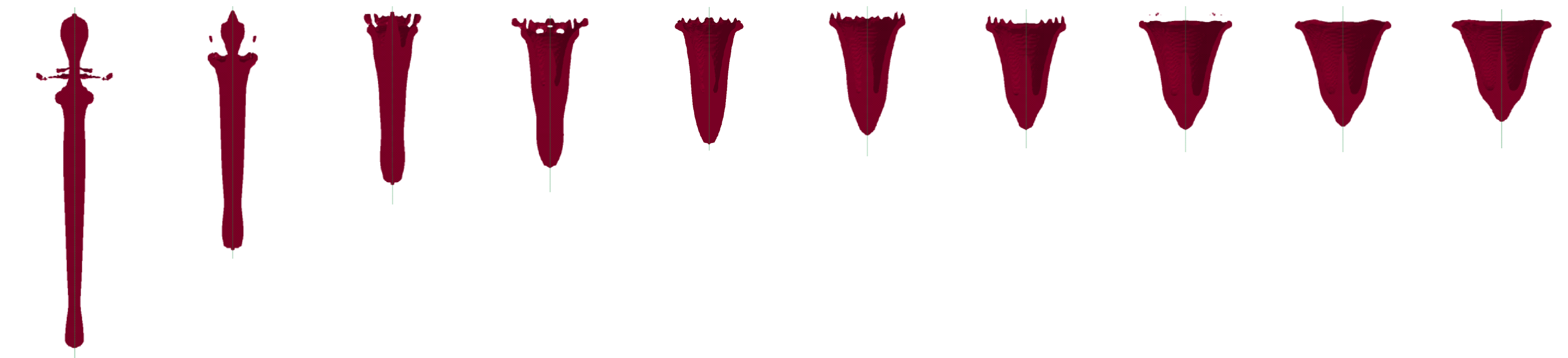 html/hncl/CJEM2018051/media/f9ed3a1d-9d9e-466d-8e79-c361a8e5ca95-image007.png