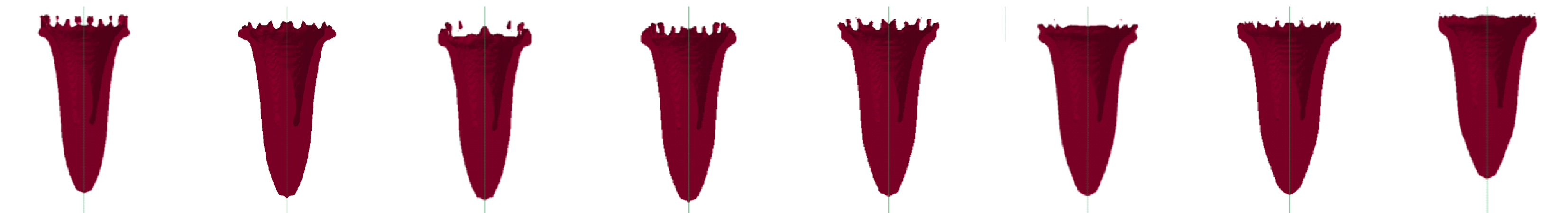 html/hncl/CJEM2018051/media/f9ed3a1d-9d9e-466d-8e79-c361a8e5ca95-image013.png